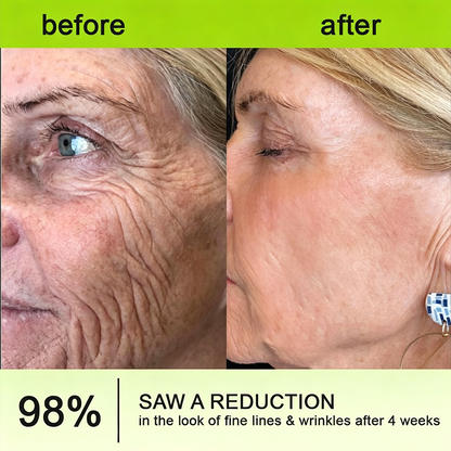 👍🌟🌿Curalona® Wrinkle-Lift Tightening cream - Last Day Promotion 70% OFF