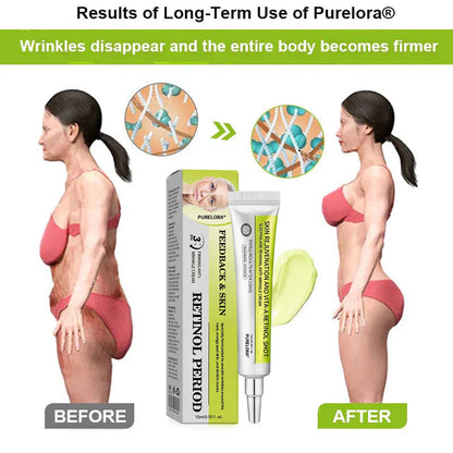 [🔥Last day 70% off] Purelora® Botox and Retinol Injection - Eraser for deep wrinkles, sagging cheeks and puffy eyes