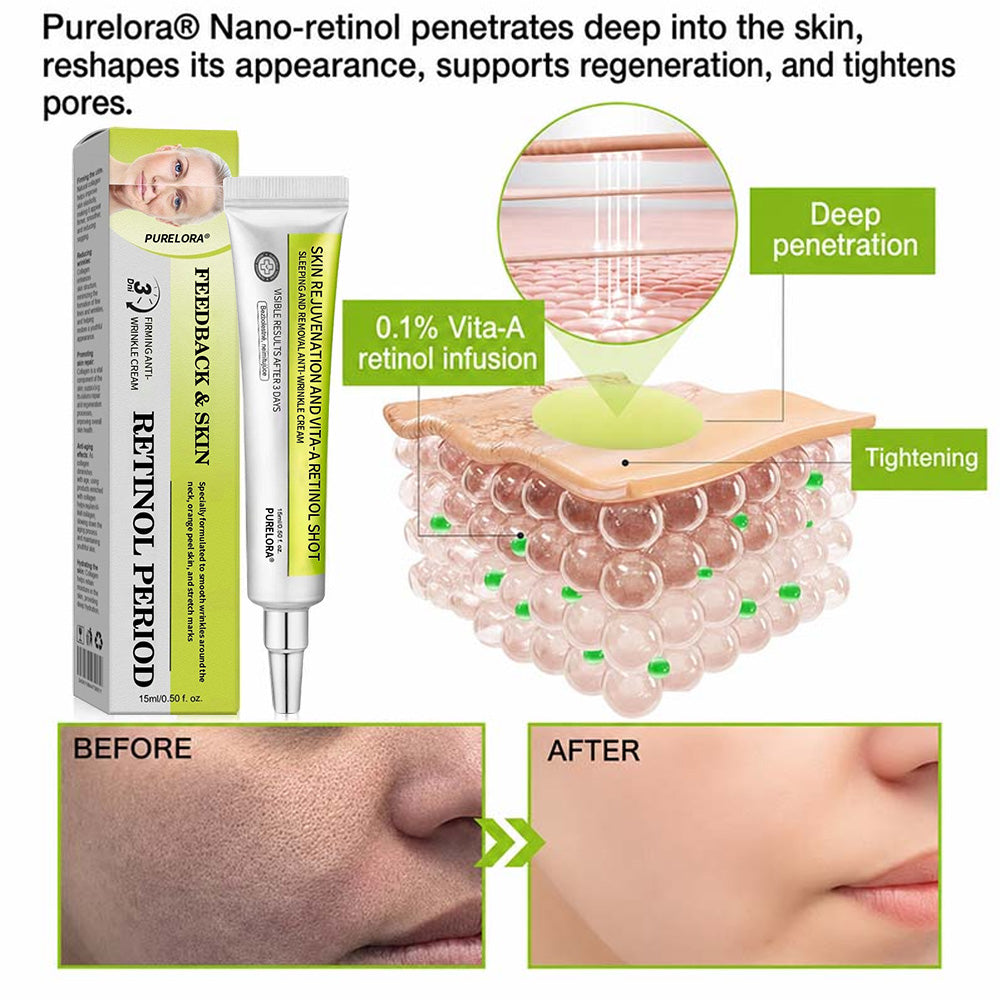 [🔥Last day 70% off] Purelora® Botox and Retinol Injection - Eraser for deep wrinkles, sagging cheeks and puffy eyes