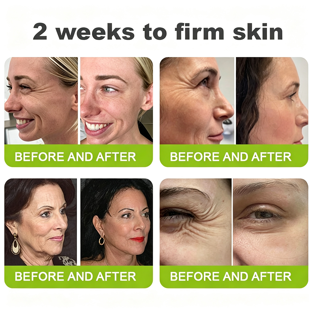👍🌟🌿Curalona® Wrinkle-Lift Tightening cream - Last Day Promotion 70% OFF