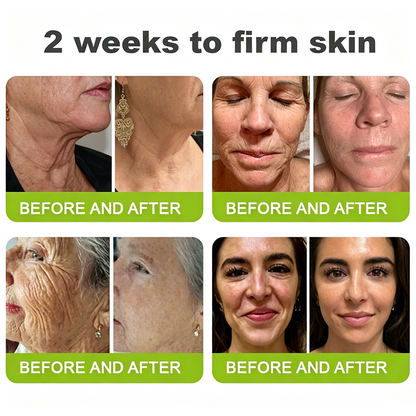 👍🌟🌿Curalona® Wrinkle-Lift Tightening cream - Last Day Promotion 70% OFF